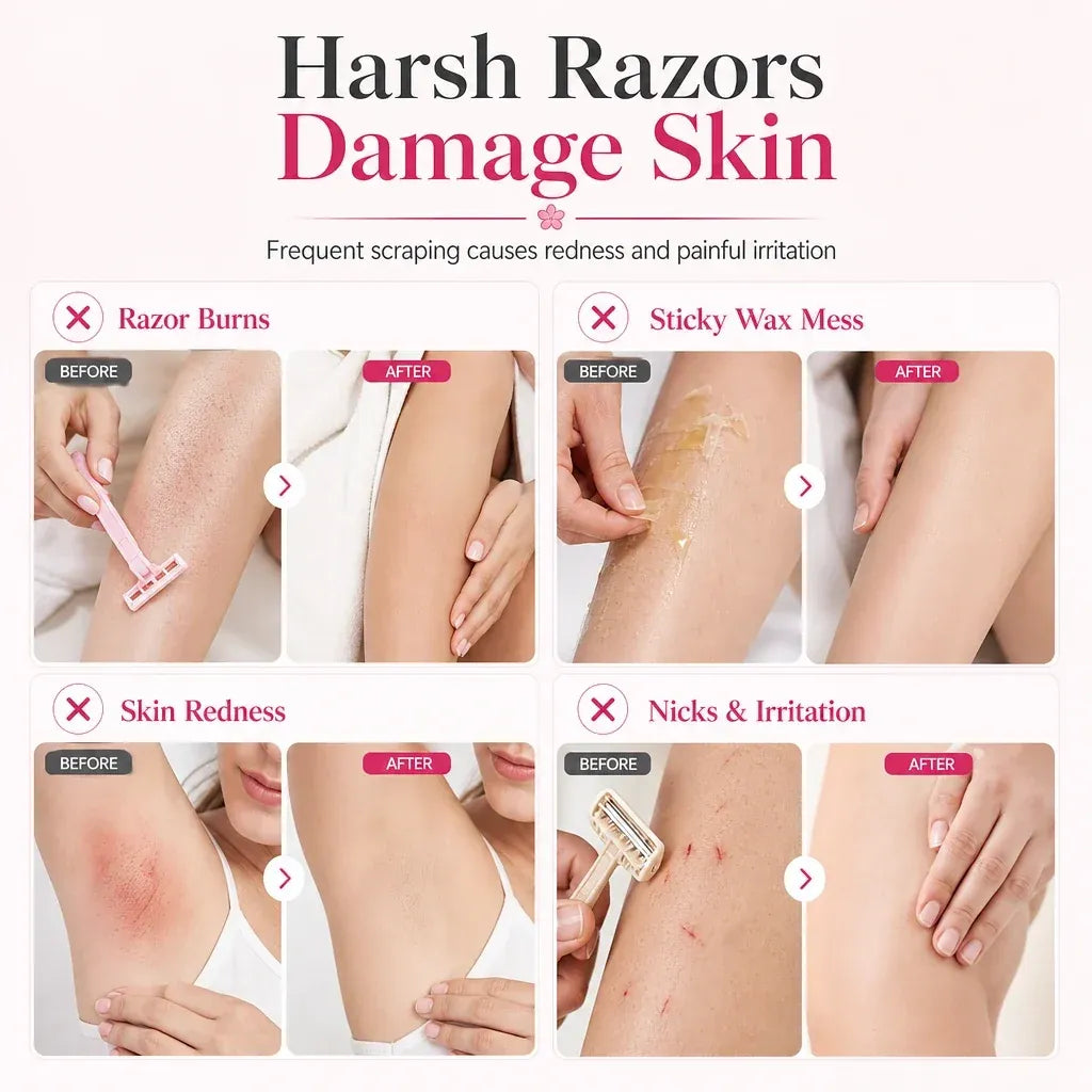 Seurico™Gentle Smooth Roll-On Hair Removal✨