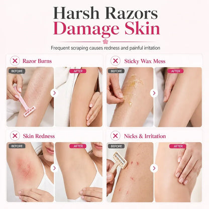 Seurico™Gentle Smooth Roll-On Hair Removal✨